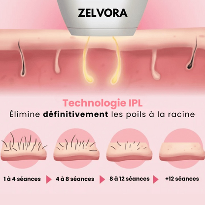 LAZER EPILATEUR CELF